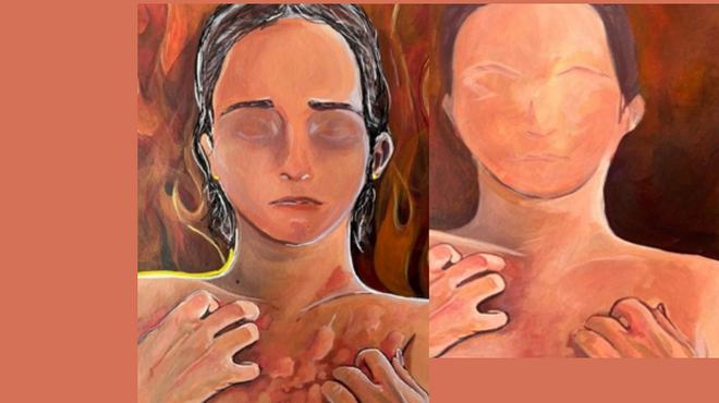 Share your experience of living with Chronic Spontaneous Urticaria (CSU)