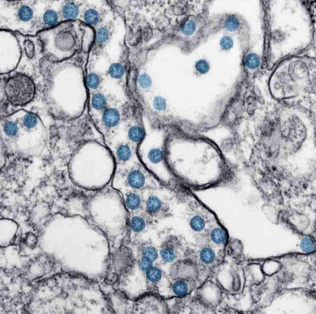 COVID-19 (Coronavirus) Update
