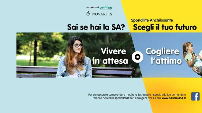 Spondilite Anchilosante Spondilite Anchilosante