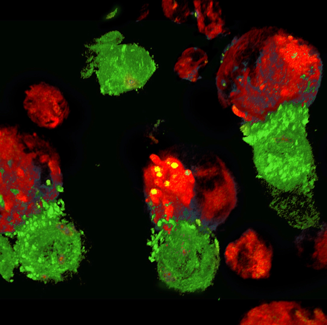 次世代CAR-Tへの挑戦