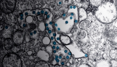 COVID-19 (Coronavirus)