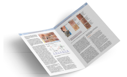 Illustratie van een brochure