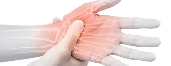 Illustratie van handpijn