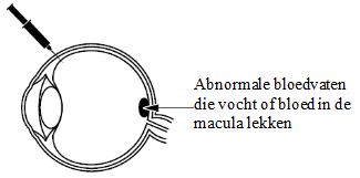 Beovu information