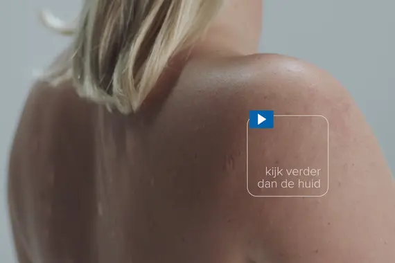 Close-up van de huid op de rug van een vrouw