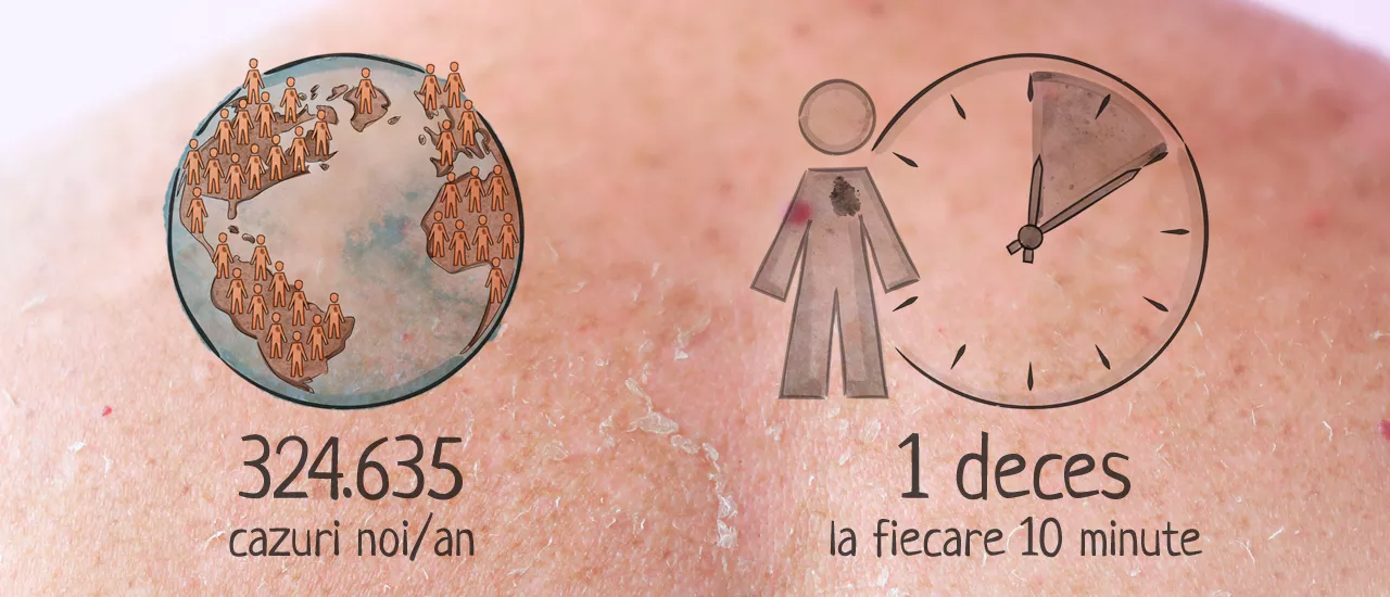 Impactul global al melanomului