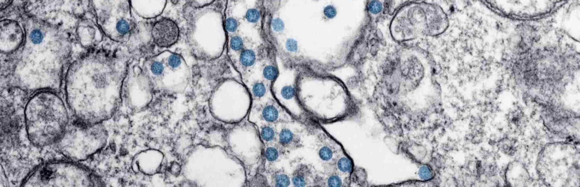 coronavirus-microscope-image