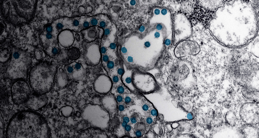 Coronavirus