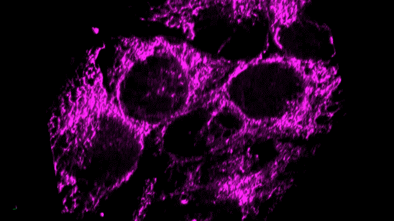 Live cell imaging of inflammation in a tumor model.