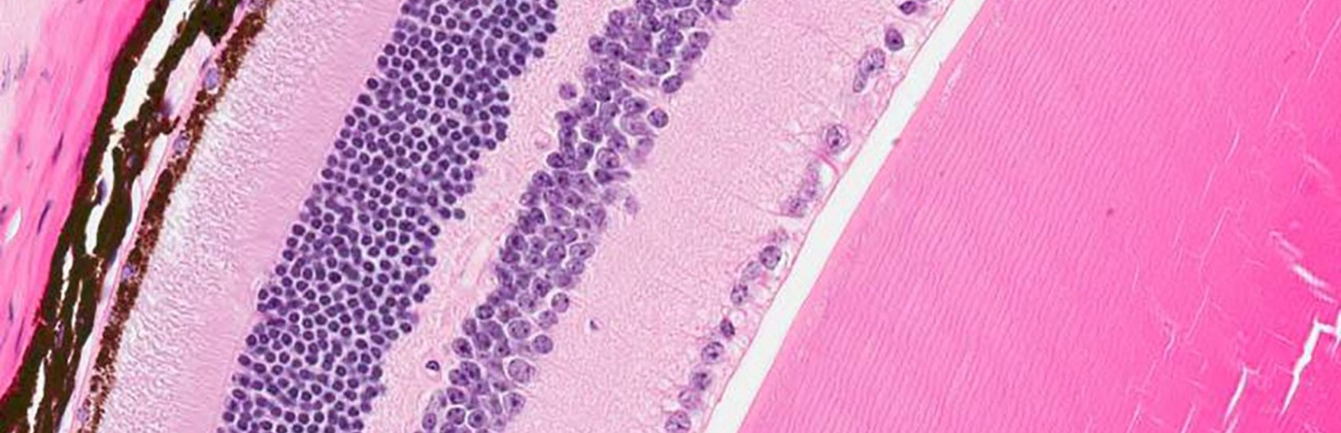 Retina cells, including some targeted by a gene therapy
