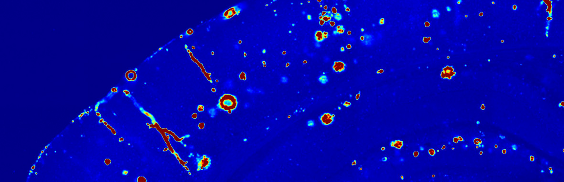 Getting down to the roots of Alzheimer’s disease