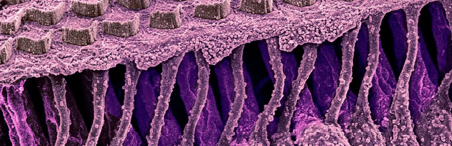 Hair cells
