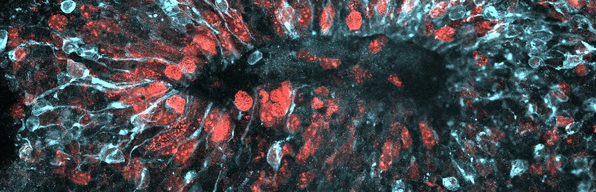 How Zika infects the growing brain