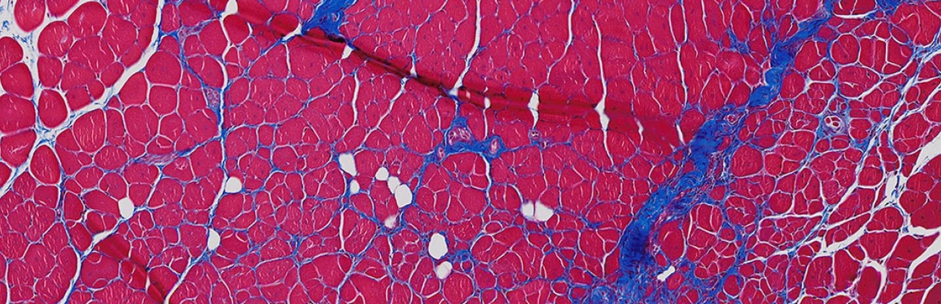 Novartis antibody increases muscle growth in mice and human cell cultures