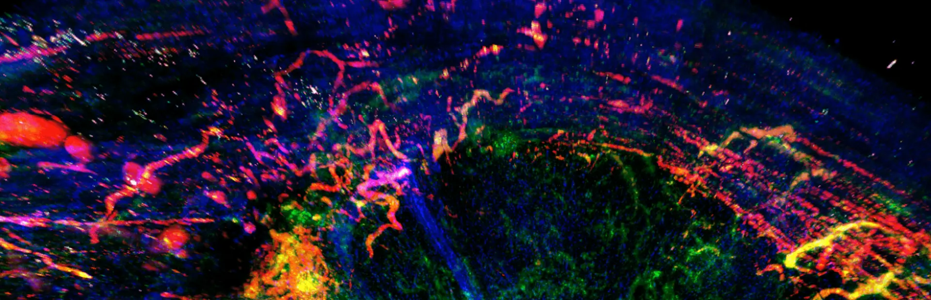 A look inside a tumor