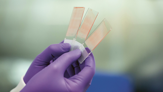 Smear test samples
