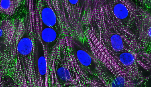 Heart muscle cells.