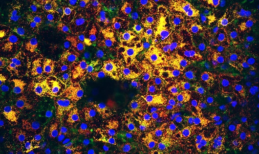 iPSC derived Hepatocytes sciart
