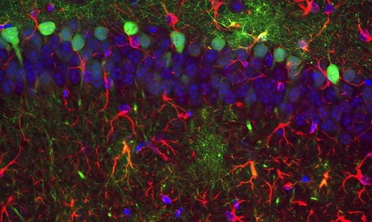 Microscopic view of a mouse brain