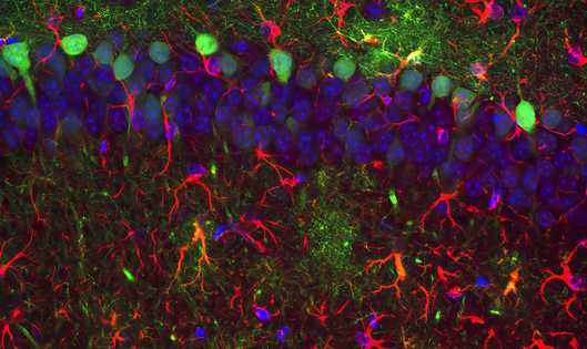 Microscopic view of a mouse brain