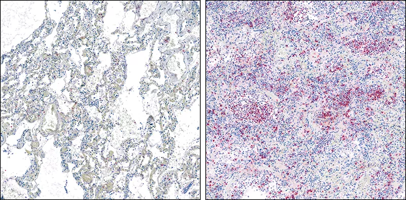 Cell samples from COVID19 lung tissue analysis