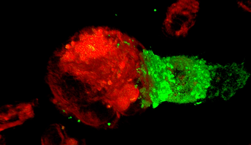 CAR-T cells attack cancer cells