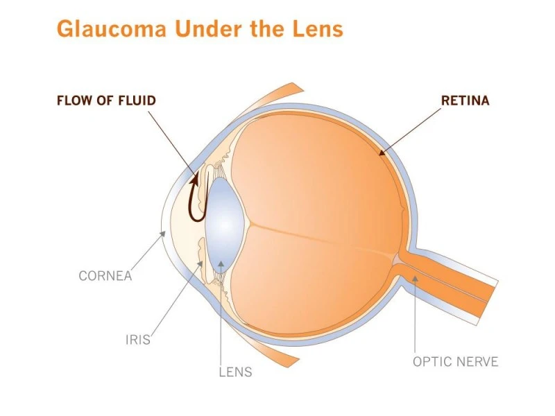 Illustration showing fluid flow through the eye