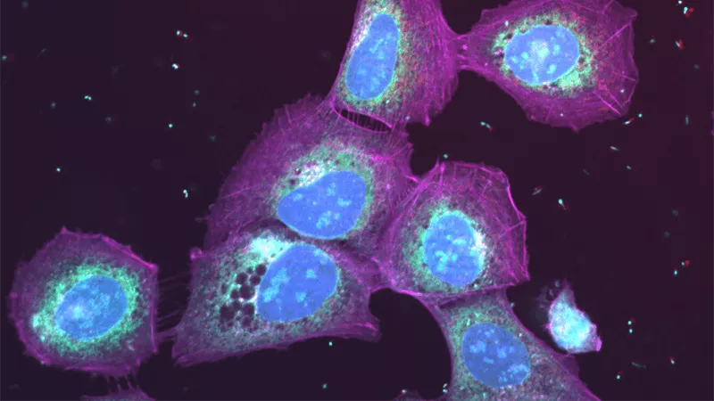Cells develop holes after treatment.