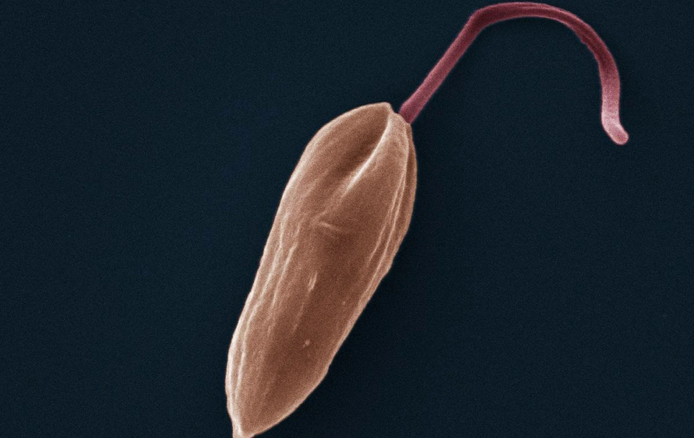 Kinetoplastids under a microscope