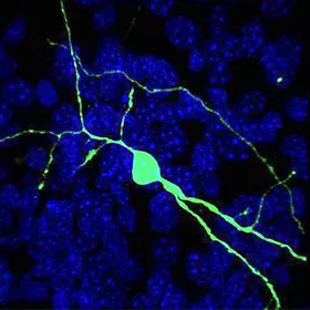 mutant-protein-spreads-through-a-neural-circuit-in-huntingtons-disease-neuron