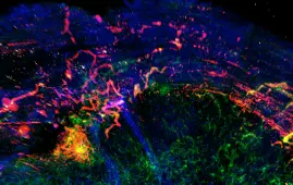 A look inside a tumor