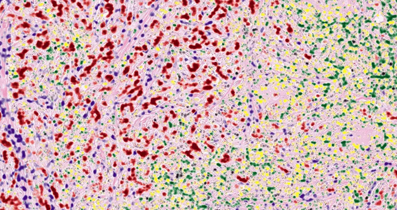 Novartis pathologists are training an AI platform to recognize cells.