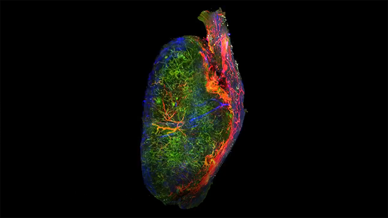 Researchers are looking for ways to prime the tumor microenvironment to make immunotherapies more effective.