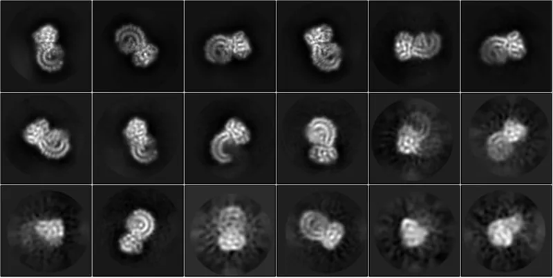 Electron microscopy image of NLRP3