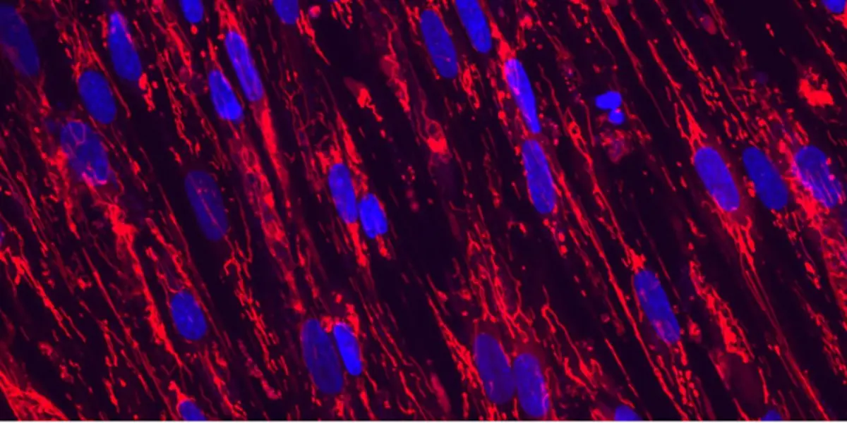 Skeletal Mitochondria