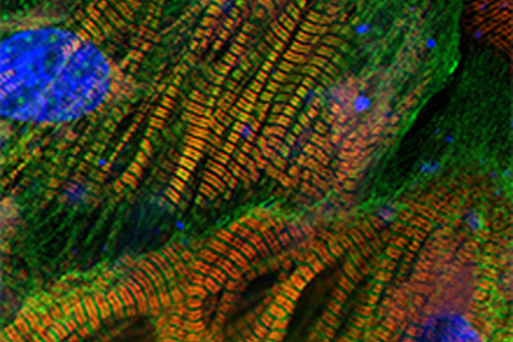 Heart muscle cells.