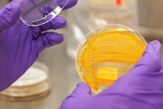 Bacteria in petri dish 
