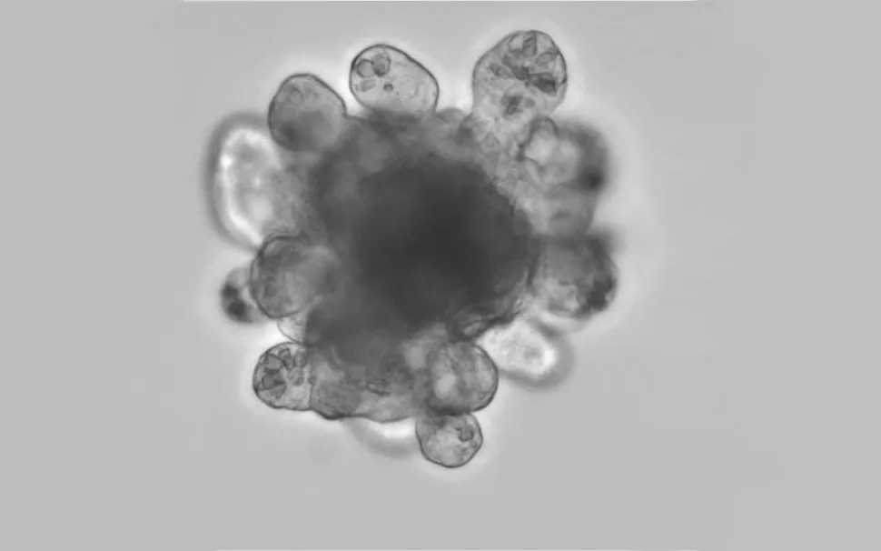 Benjamin learned to build mini-guts, which resemble flowers. Petal-like structures form as intestinal stem cells divide and differentiate