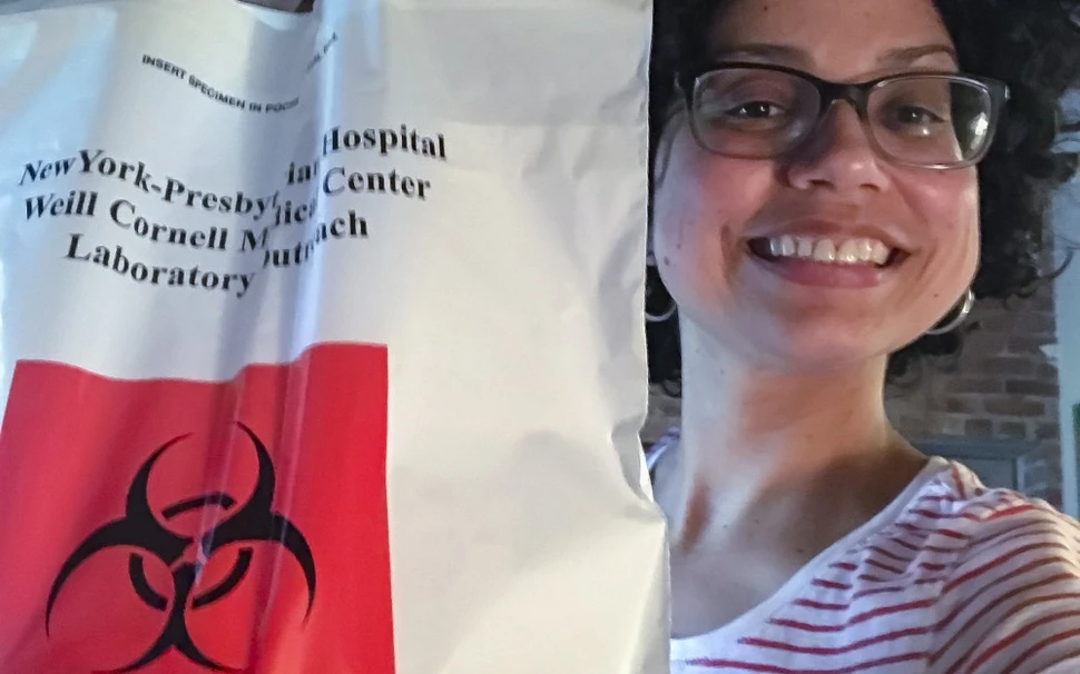 Kidney patient showing a bag containing her urine specimen