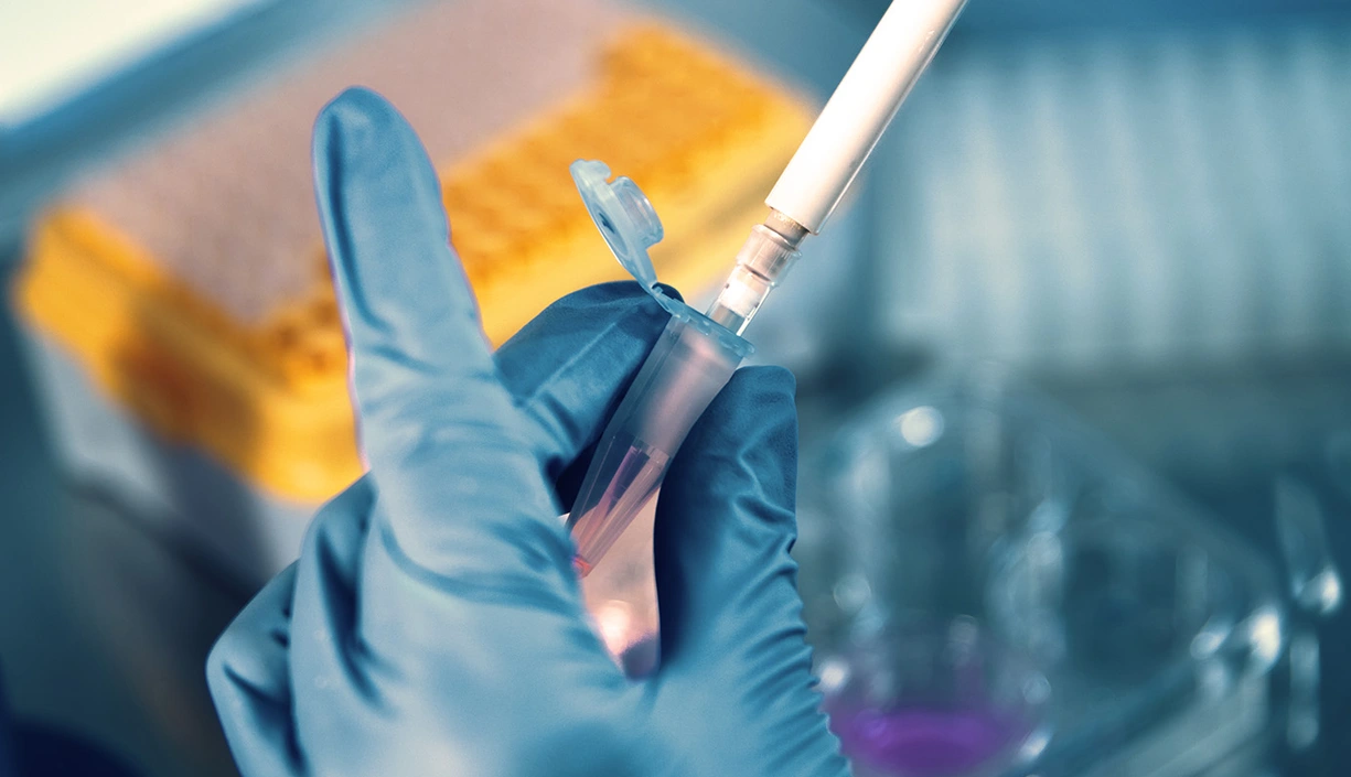 Close up on the hands of a laboratory technician wearing blue gloves preparing a sample with pipette