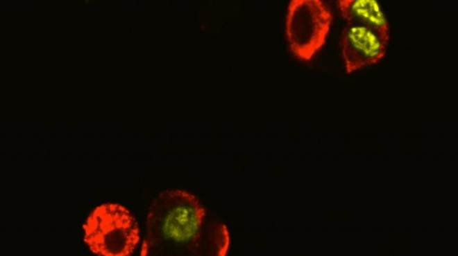 Compounds spur insulin-producing cells to replicate in the lab Compounds spur insulin-producing cells to replicate in the lab