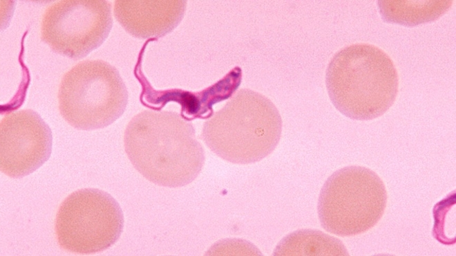 Blood smear from patient with African Sleeping sickness (Centers for Disease Control and Prevention)