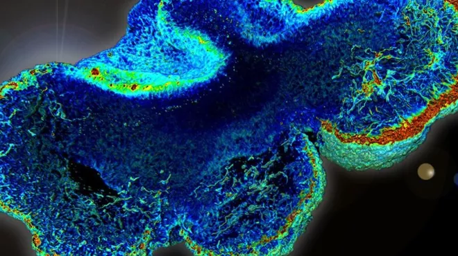 Building brain organoids to shed light on disease