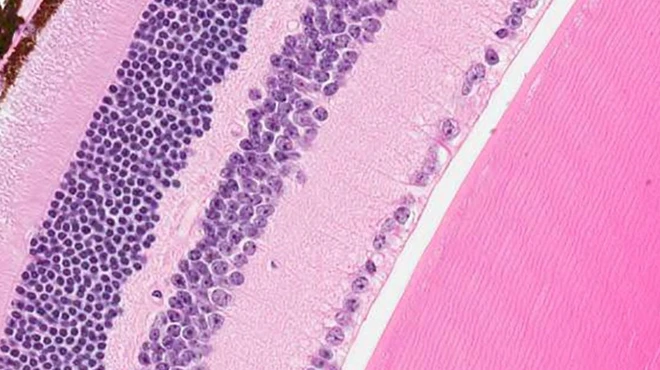 Retina cells, including some targeted by a gene therapy