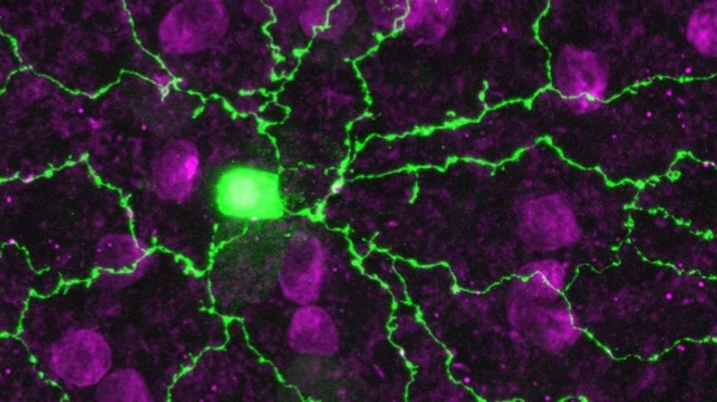 Eye disease tracked to a glitch in starburst cells Eye disease tracked to a glitch in starburst cells