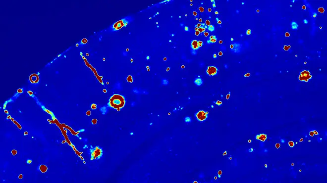 Getting down to the roots of Alzheimer’s disease