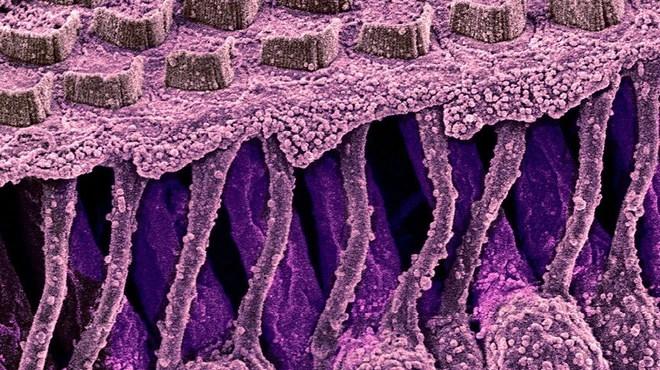 Hair cells