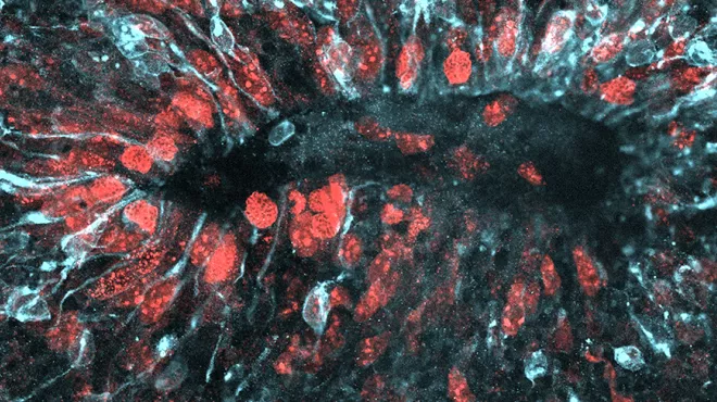 How Zika infects the growing brain