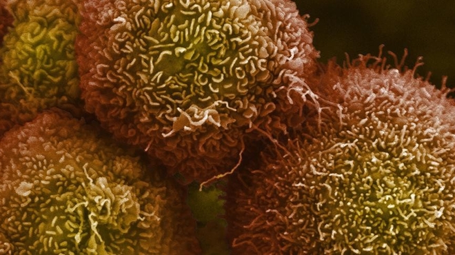 Intractable tumor cells crippled Intractable tumor cells crippled