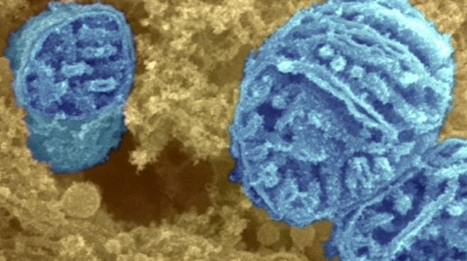 Stopping free radicals at their source